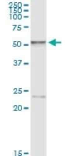Hexosaminidase A/HEXA Antibody (3D1), Novus Biologicals 0.05 mg, Unconjugated:Antibodies,
