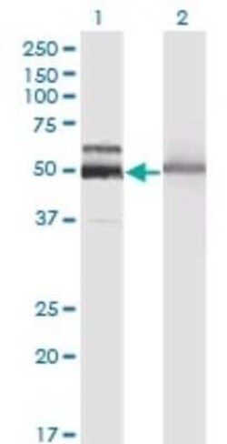 Hexosaminidase A/HEXA Antibody (3D1), Novus Biologicals 0.05 mg, Unconjugated:Antibodies,