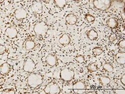 Hey L Antibody (1F6), Novus Biologicals 0.1 mg | Buy Online | Novus Biologicals | Fisher Scientific