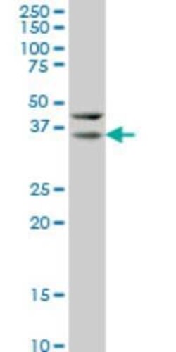 Hey L Antibody (1F6), Novus Biologicals 0.1 mg | Buy Online | Novus Biologicals | Fisher Scientific