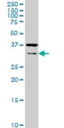 Novus Biologicals Hey L Antibody (4A11), Novus Biologicals 0.1 mg | Buy Online | Novus Biologicals&trade; | Fisher Scientific