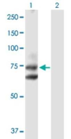 Hip Antibody, Novus Biologicals 0.1 mg; Unconjugated:Antibodies, Polyclonal