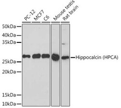 Hippocalcin Rabbit anti-Human, Mouse, Rat, Clone: 6N2A6, Novus Biologicals:Antibodies:Primary