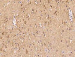 Hippocalcin Antibody, Novus Biologicals 50 &mu;g; Unconjugated:Antibodies,