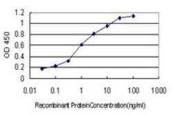 Hippocalcin like 4 Antibody (2B11), Novus Biologicals 0.1 mg | Buy Online | Novus Biologicals | Fisher Scientific