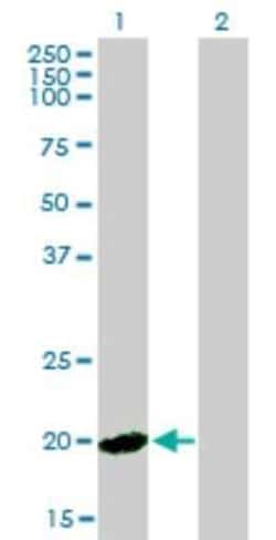 Hippocalcin like 4 Antibody (2B11), Novus Biologicals 0.1 mg | Buy Online | Novus Biologicals | Fisher Scientific