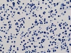 Novus Biologicals His Tag Antibody (RM146), Novus Biologicals™