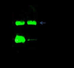 Histamine N-Methyltransferase/HNMT Rabbit anti-Human, Clone: 34, Novus