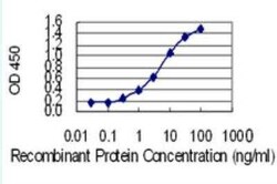 Histamine N-Methyltransferase/HNMT Antibody (2G24), Novus Biologicals 50 &mu;g | Buy Online | Novus Biologicals | Fisher Scientific