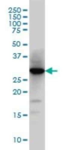 Novus Biologicals Histamine N-Methyltransferase/HNMT Antibody (3G12), Novus Biologicals 0.1 mg | Buy Online | Novus Biologicals&trade; | Fisher Scientific