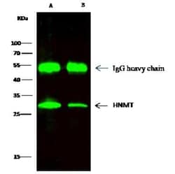 Histamine N-Methyltransferase/HNMT Antibody, Novus Biologicals 50 &mu;g;