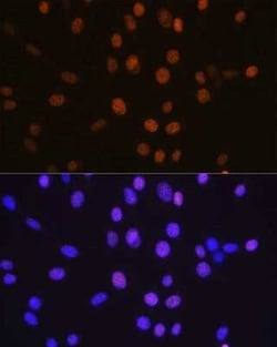 Histone Deacetylase 2/HDAC2 Rabbit anti-Human, Mouse, Rat, Clone: 10R7O1,