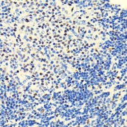 Histone Deacetylase 2/HDAC2 Rabbit anti-Human, Mouse, Rat, Clone: 10R7O1,