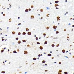 Histone Deacetylase 2/HDAC2 Rabbit anti-Human, Mouse, Rat, Clone: 10R7O1,
