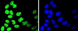 HistoneDeacetylase2/HDAC2 Rabbit anti-Human, Clone: SY29-02, Novus Biologicals 100 &mu;L | Buy Online | Novus Biologicals | Fisher Scientific