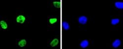 HistoneDeacetylase2/HDAC2 Rabbit anti-Human, Clone: SY29-02, Novus Biologicals 100 &mu;L | Buy Online | Novus Biologicals | Fisher Scientific