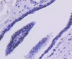 HistoneDeacetylase2/HDAC2 Rabbit anti-Human, Clone: SY29-02, Novus Biologicals 100 &mu;L | Buy Online | Novus Biologicals | Fisher Scientific