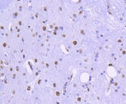 HistoneDeacetylase2/HDAC2 Rabbit anti-Human, Clone: SY29-02, Novus Biologicals 100 &mu;L | Buy Online | Novus Biologicals | Fisher Scientific