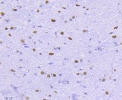 HistoneDeacetylase2/HDAC2 Rabbit anti-Human, Clone: SY29-02, Novus Biologicals 100 &mu;L | Buy Online | Novus Biologicals | Fisher Scientific