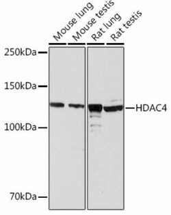 Histone Deacetylase 4/HDAC4 Rabbit anti-Mouse, Rat, Clone: 9A6E2, Novus