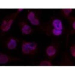 Histone Deacetylase 4/HDAC4, p Ser632 Antibody - BSA Free, Novus Biologicals:Antibodies:Primary