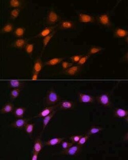 Histone Deacetylase 8/HDAC8 Rabbit anti-Human, Mouse, Rat, Clone: 1O2Y5, Novus Biologicals 100 &mu;g | Buy Online | Novus Biologicals | Fisher Scientific