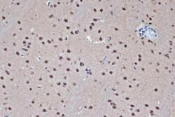 Histone Deacetylase 8/HDAC8 Rabbit anti-Human, Mouse, Rat, Clone: 1O2Y5, Novus Biologicals 100 &mu;g | Buy Online | Novus Biologicals | Fisher Scientific