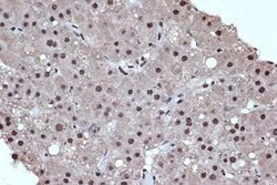 Histone Deacetylase 8/HDAC8 Rabbit anti-Human, Mouse, Rat, Clone: 1O2Y5, Novus Biologicals 100 &mu;g | Buy Online | Novus Biologicals | Fisher Scientific