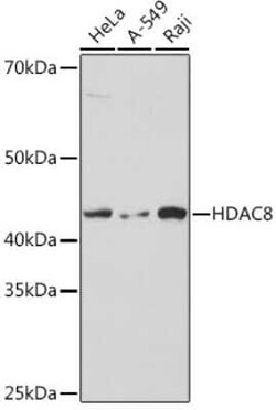 Histone Deacetylase 8/HDAC8 Rabbit anti-Human, Mouse, Rat, Clone: 1O2Y5, Novus Biologicals 100 &mu;g | Buy Online | Novus Biologicals | Fisher Scientific