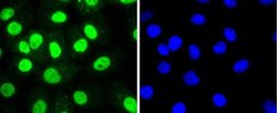 Histone Deacetylase 8/HDAC8 Antibody (JJ0845), Novus Biologicals 100&mu;L:Antibodies,