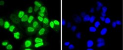 Histone Deacetylase 8/HDAC8 Antibody (JJ0845), Novus Biologicals 100&mu;L:Antibodies,