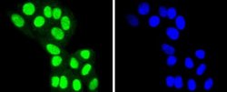 Histone Deacetylase 8/HDAC8 Antibody (JJ0845), Novus Biologicals 100&mu;L:Antibodies,