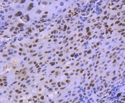Histone Deacetylase 8/HDAC8 Antibody (JJ0845), Novus Biologicals 100&mu;L:Antibodies,