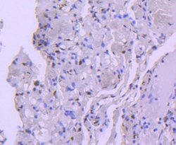 Histone Deacetylase 8/HDAC8 Antibody (JJ0845), Novus Biologicals 100&mu;L:Antibodies,