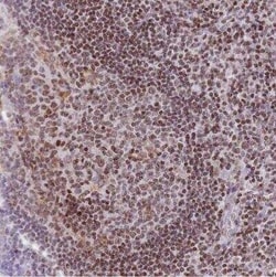 Histone Deacetylase 8/HDAC8 Antibody, Novus Biologicals 0.1 mL; Unconjugated:Anticuerpos