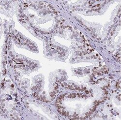 Histone Deacetylase 8/HDAC8 Antibody, Novus Biologicals 0.1 mL; Unconjugated:Anticuerpos