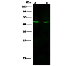Histone Deacetylase 8/HDAC8 Antibody, Novus Biologicals 50 &mu;g, Unconjugated:Antibodies,