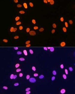 Histone H1.2 Rabbit anti-Human, Mouse, Rat, Clone: 9T9Q7, Novus Biologicals 20 &mu;g | Buy Online | Novus Biologicals | Fisher Scientific