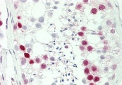 Histone H1.2 Antibody, Novus Biologicals 100 &mu;L; Unconjugated:Antibodies,