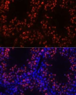 Histone H1T Rabbit anti-Mouse, Rat, Polyclonal, Novus Biologicals 100 &mu;g;