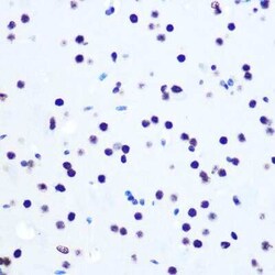 Histone H2AX Rabbit anti-Human, Mouse, Rat, Clone: 4Z3S8, Novus Biologicals 100 &mu;g | Buy Online | Novus Biologicals | Fisher Scientific