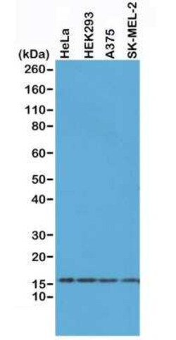 Histone H2AX Antibody (RM214), Novus Biologicals 100 &mu;g; Unconjugated:Antibodies,