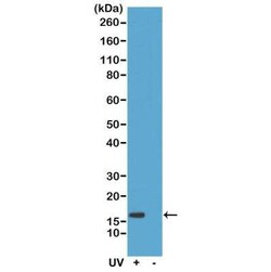 Histone H2AX, p Ser139 Antibody (RM224), Novus Biologicals 100 &mu;g; Unconjugated:Antibodies,