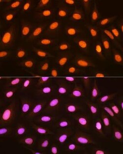 Histone H2AY/macroH2A.1 Rabbit anti-Human, Mouse, Rat, Clone: 4D2O4, Novus