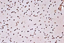 Histone H2AY/macroH2A.1 Rabbit anti-Human, Mouse, Rat, Clone: 4D2O4, Novus