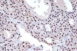Histone H2AY/macroH2A.1 Rabbit anti-Human, Mouse, Rat, Clone: 4D2O4, Novus
