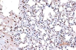 Histone H2AY/macroH2A.1 Rabbit anti-Human, Mouse, Rat, Clone: 4D2O4, Novus