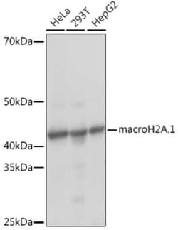 Histone H2AY/macroH2A.1 Rabbit anti-Human, Mouse, Rat, Clone: 4D2O4, Novus