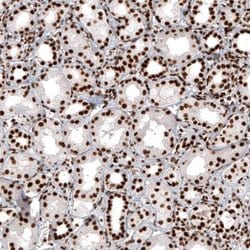 Histone H2AY/macroH2A.1 Antibody (CL5245), Novus Biologicals 25 &mu;L:Antibodies,