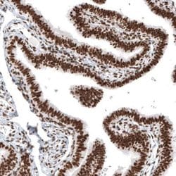 Histone H2AY/macroH2A.1 Antibody (CL5245), Novus Biologicals 25 &mu;L:Antibodies,